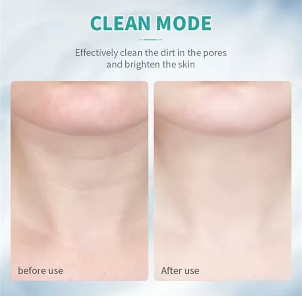 SKINÉLLE™ Photon EMS Rejuvenation System