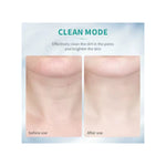 Skinélle™ Photon EMS Rejuvenation System