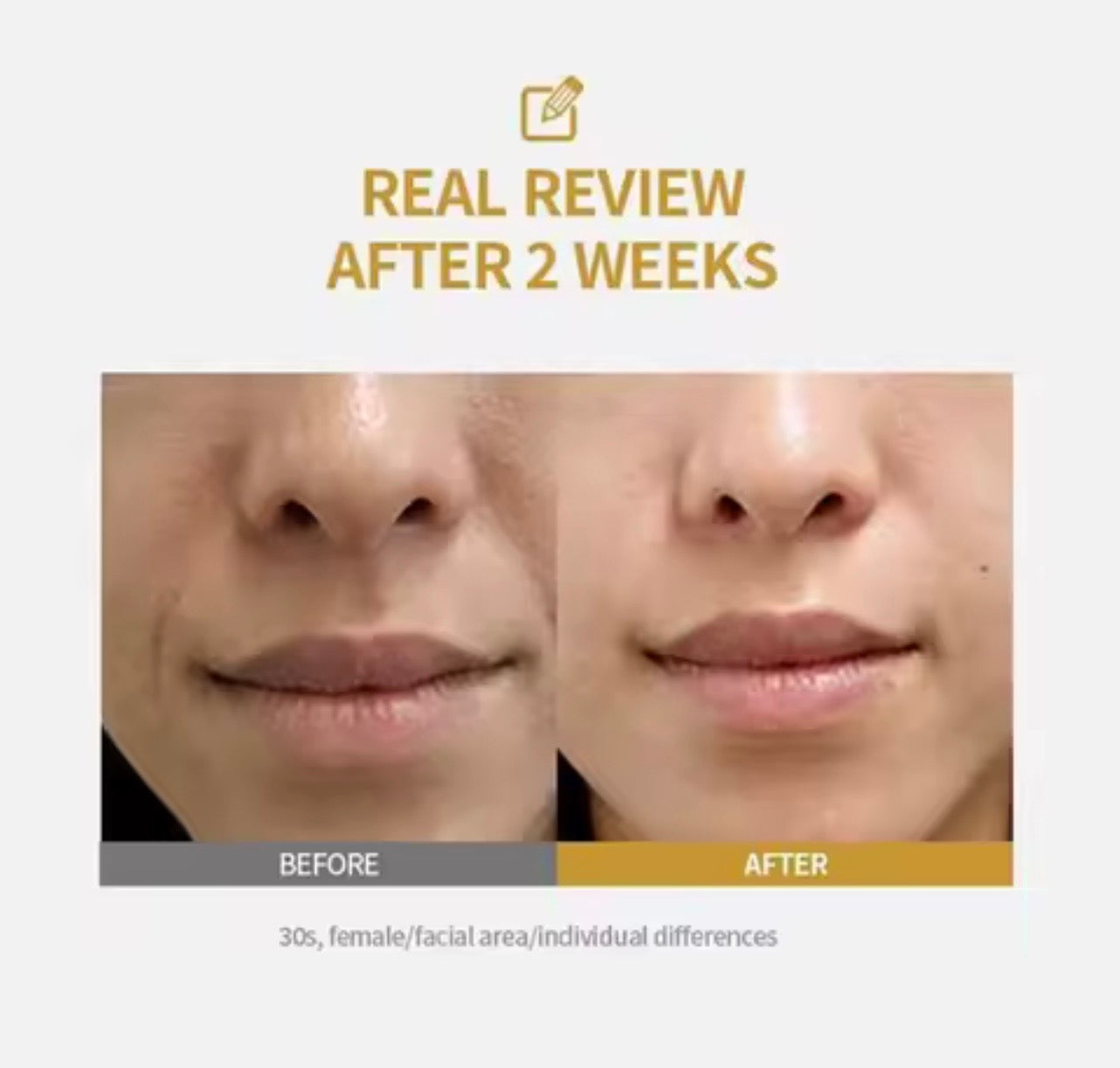 SkinLift™